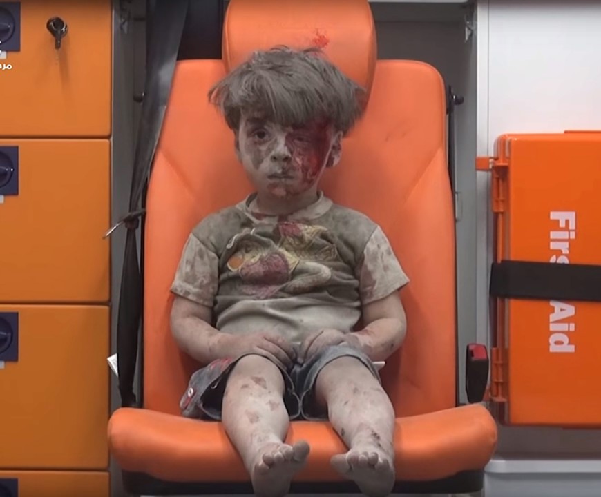 Il piccolo Omran come il piccolo Aylan