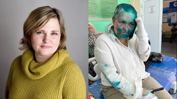 Yelena Milashina vittima di un brutale pestaggio, la condanna dei giornalisti europei